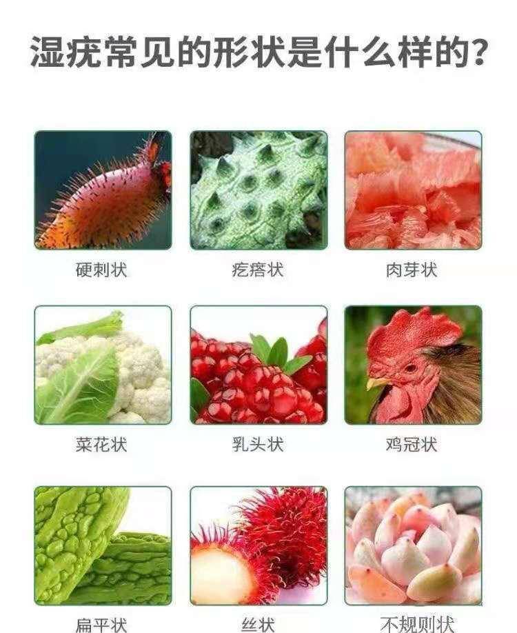 尖锐湿疣治疗后几个月不复发，疾病控制的关键期与后续观察